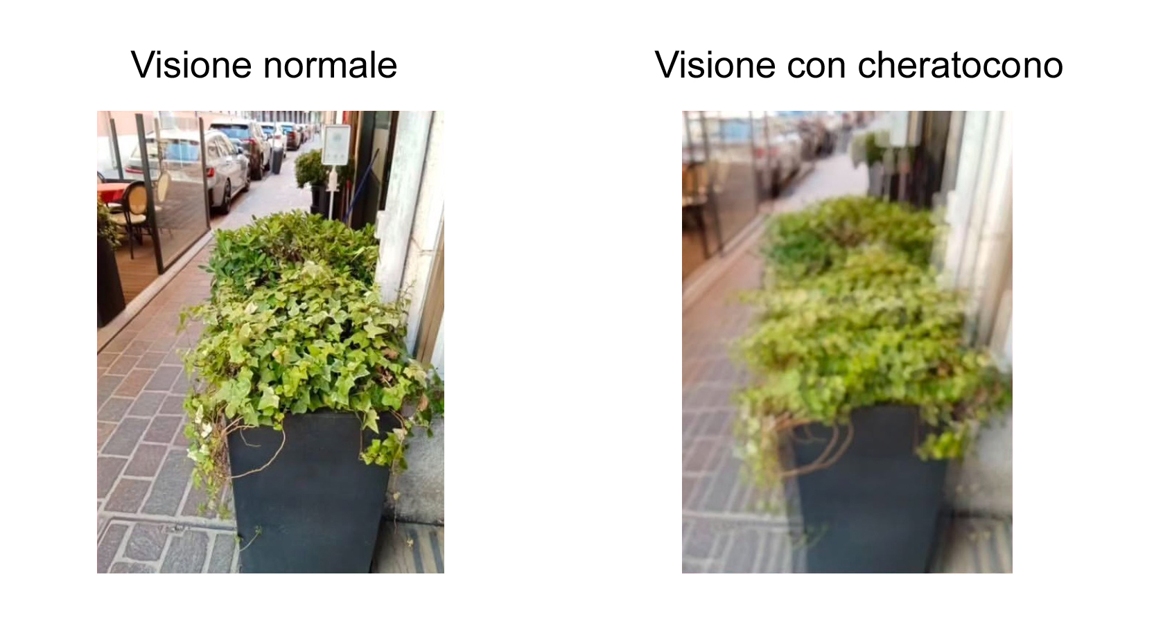 visione normale e con cheratono